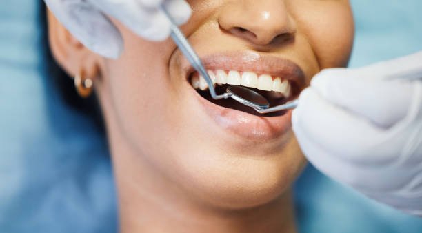 Best Broken or Chipped Tooth Repair in Troy, IL